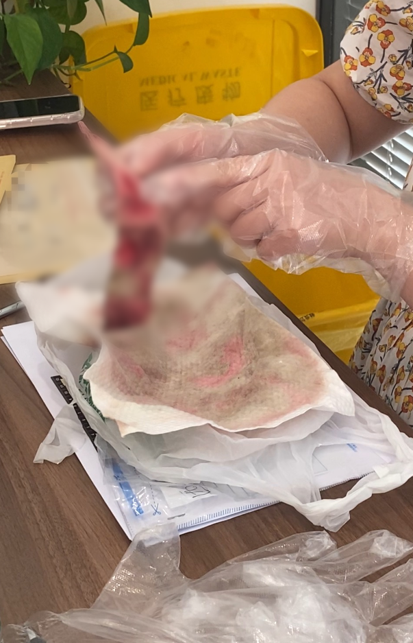 纸巾”鉴定确认有人血成分！最新通报：来源已查清j9九游会网站入口女子在飞机置物袋发现“带血湿(图4)